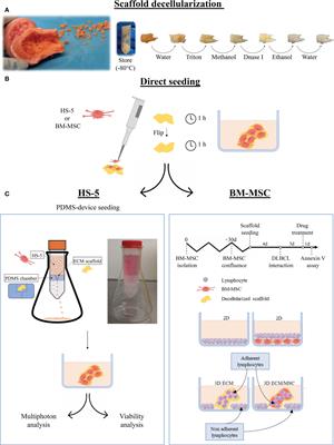 A bone-based 3D scaffold as an in-vitro model of microenvironment–DLBCL lymphoma cell interaction